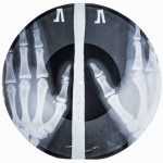 vinyl record made out of a hand radiograph